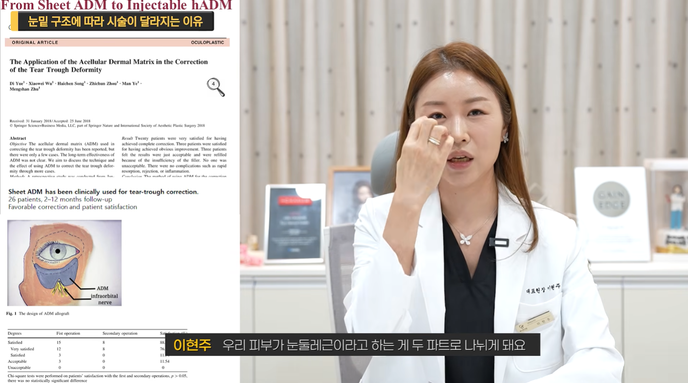눈밑꺼짐 그림자 다크서클